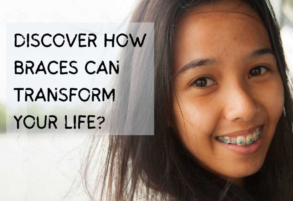 Braces They Transform Your Smile, But Can They Transform Your Life