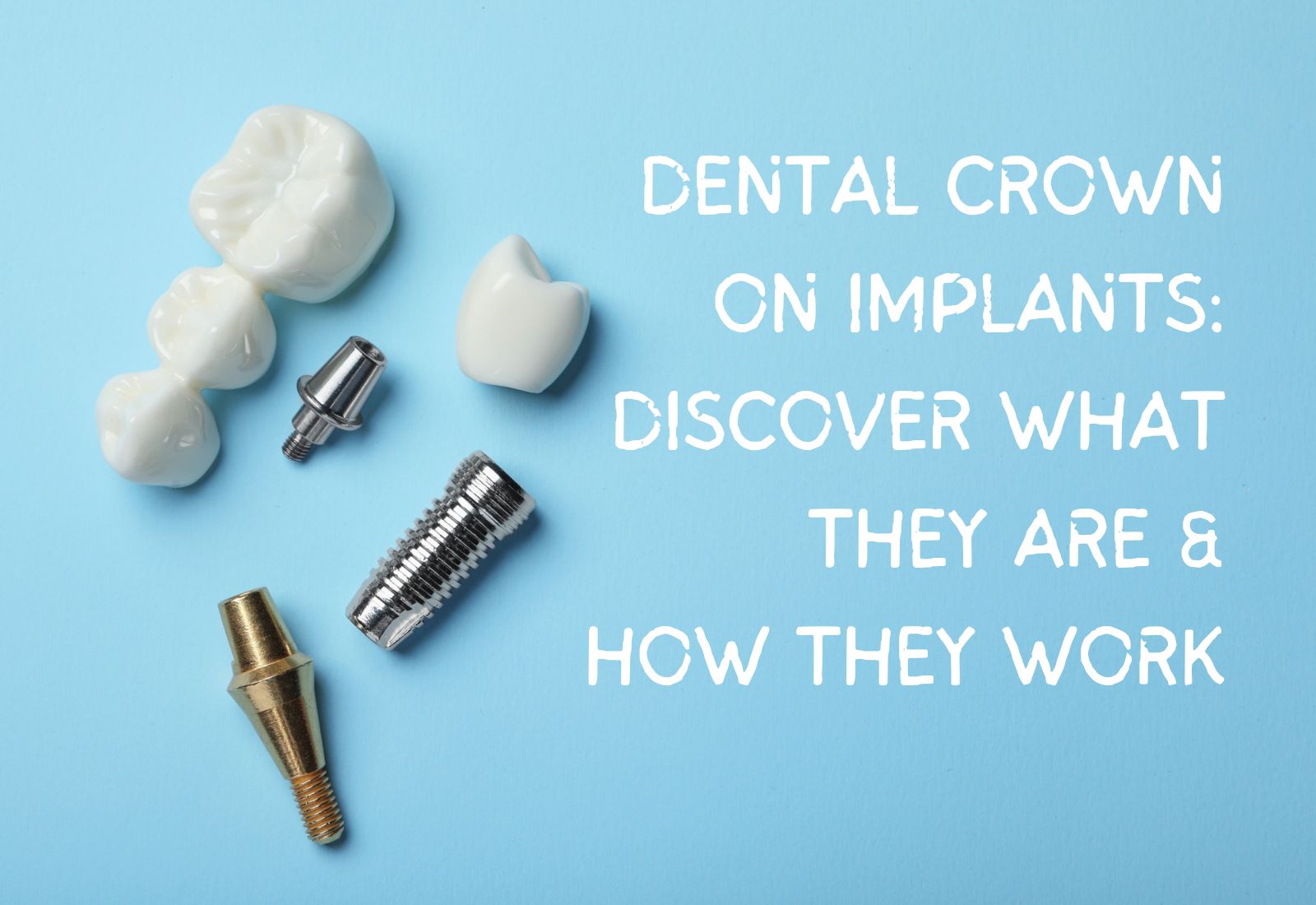 Dental Crowns on Implants The Key To Your New Smile ABC Dental l