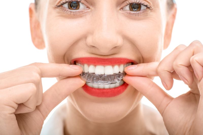 Chicago Invisalign Vs. Regular Braces:  Choosing the Right Orthodontic Treatment