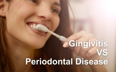 Gingivitis VS. Periodontal Disease